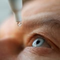 Understanding the Recovery Process after LASIK Surgery